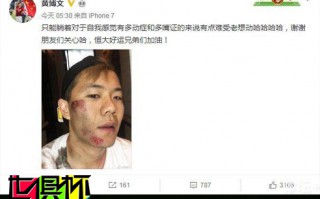 黃博文笑對賽季報銷 隊友：加油兄弟趕上世俱杯